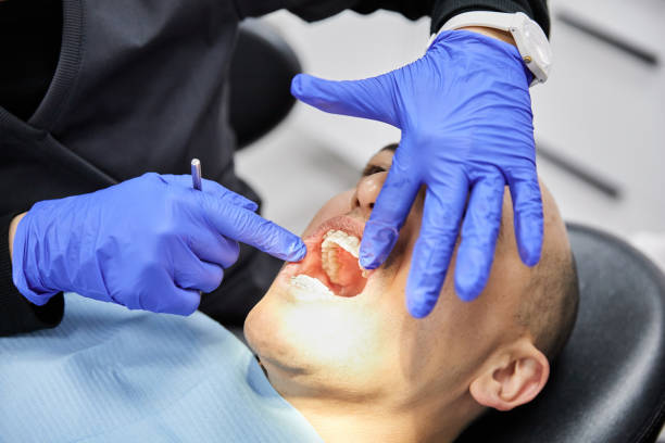 Best Urgent Tooth Repair  in Manhattan Beach, CA